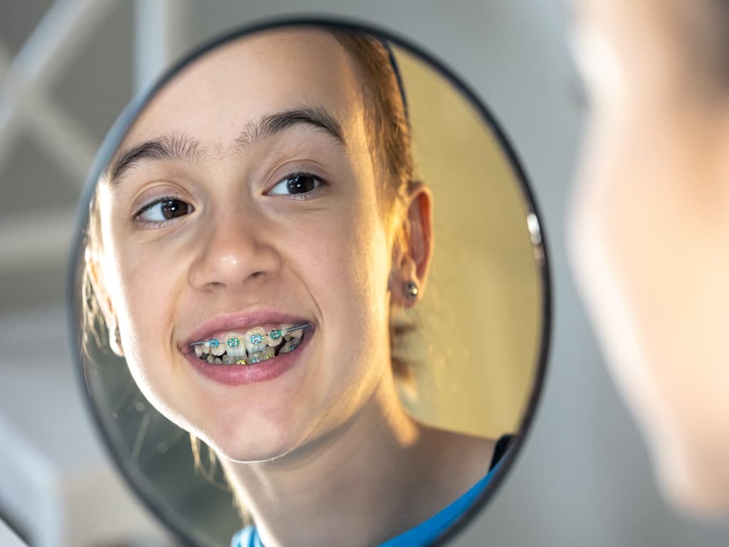 How AOS Makes Braces Affordable