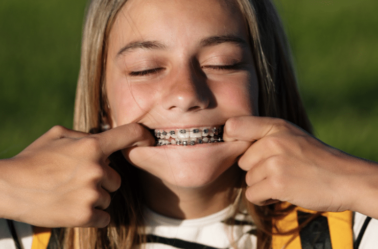 8 Common Myths About Braces Debunked: Separating Fact from Fiction