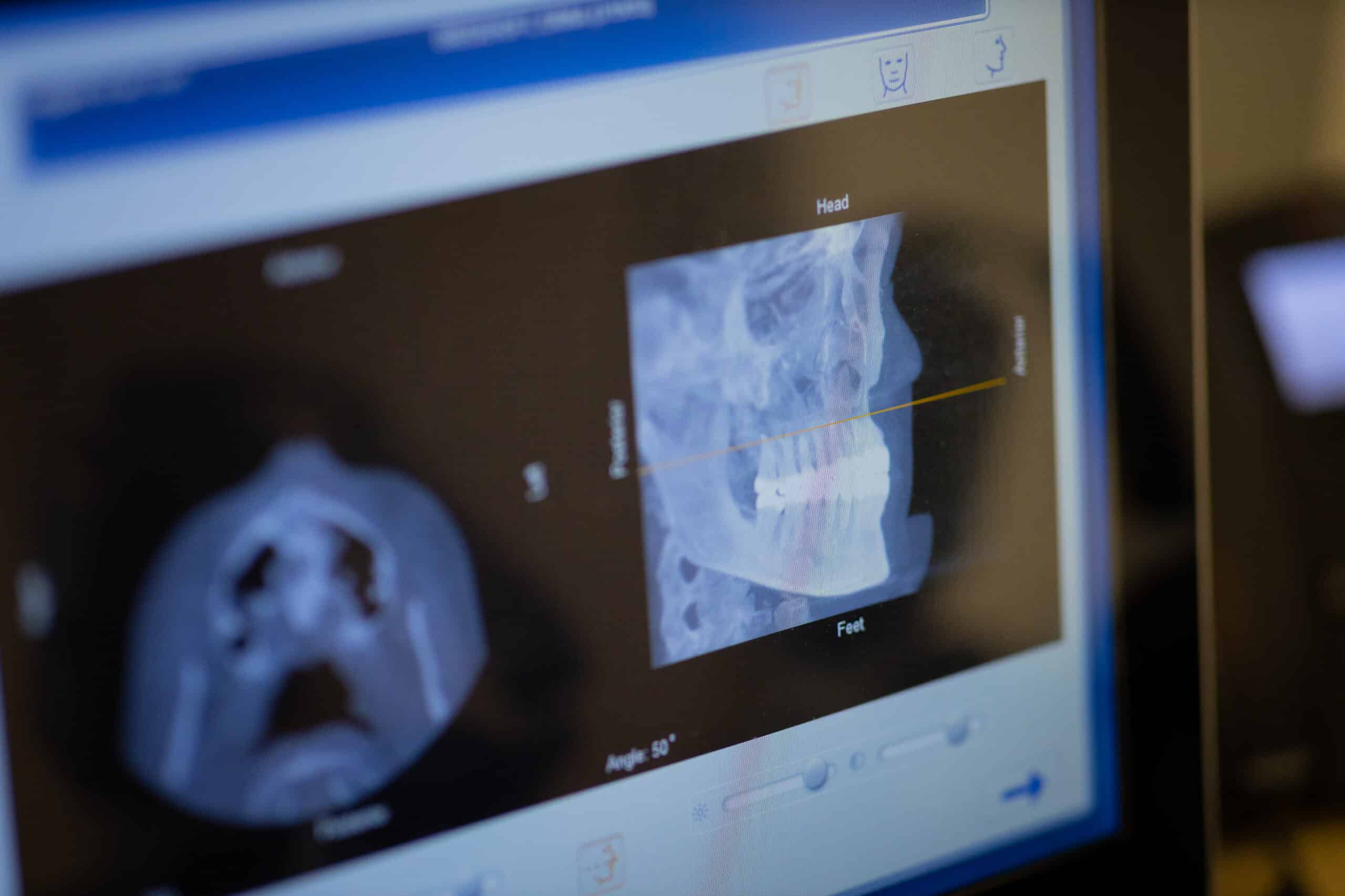 dental imagery displayed on a computer monitor
